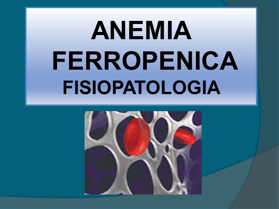 Pdf en anemia ferropenica pediatria